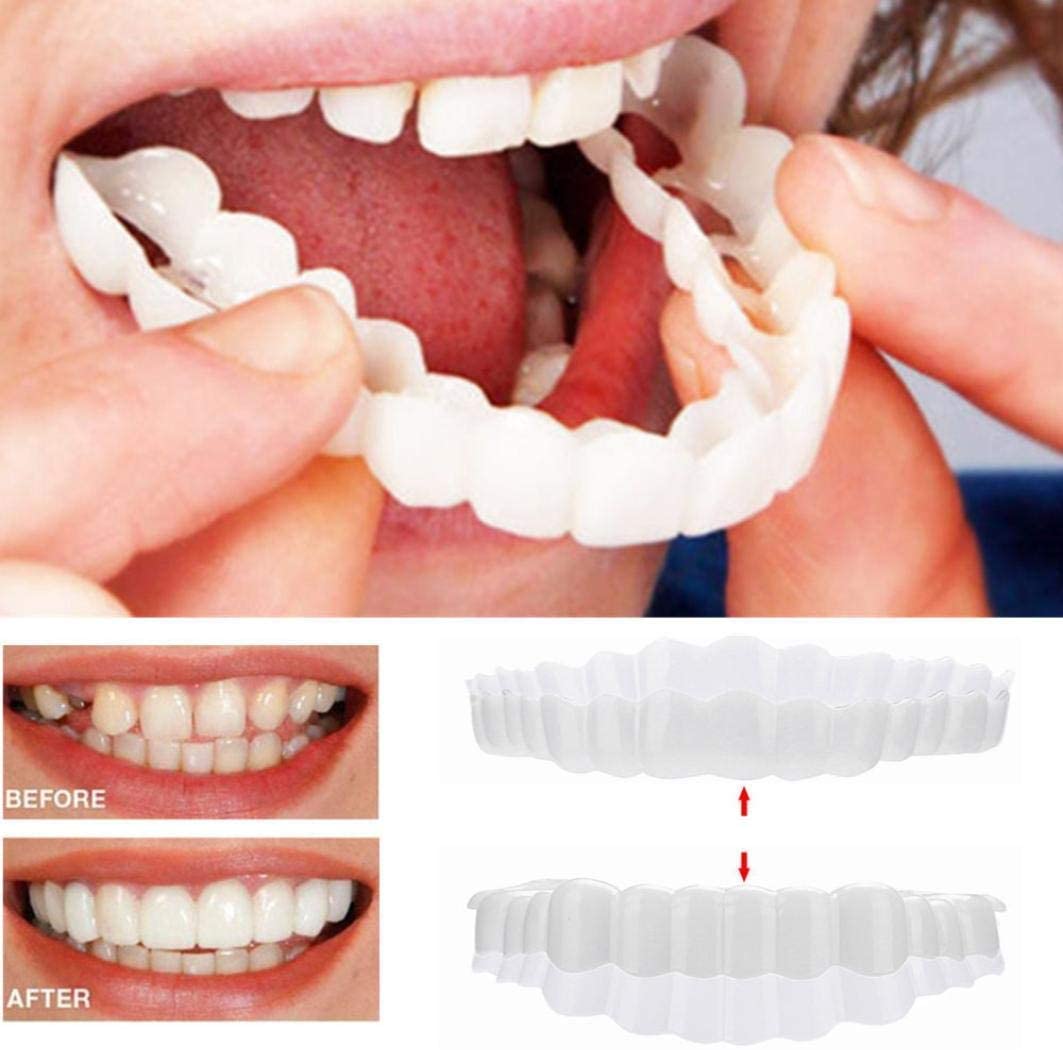 Dental Veneers for Crooked or Stained Teeth – Clip-On Smile Cover, Fast & Comfortable