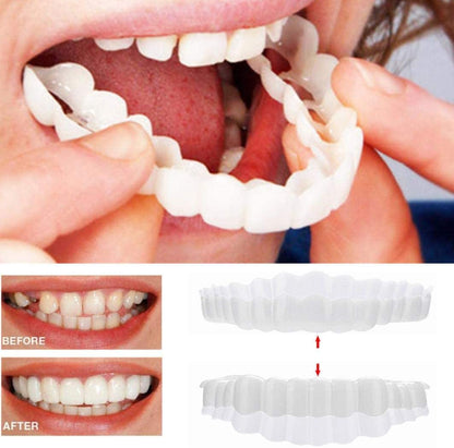 Dental Veneers for Crooked or Stained Teeth – Clip-On Smile Cover, Fast & Comfortable