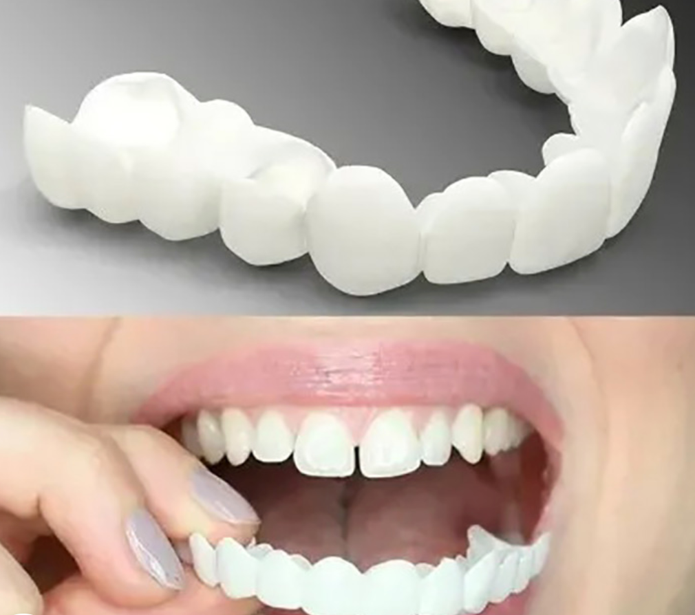 Dentures Snap-On Cosmetic Teeth for Missing, Crooked, or Damaged Teeth