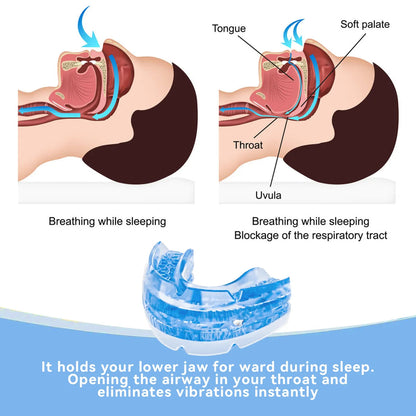 Snoring Mouth Guard Adjustable Anti Snoring Sleep Device