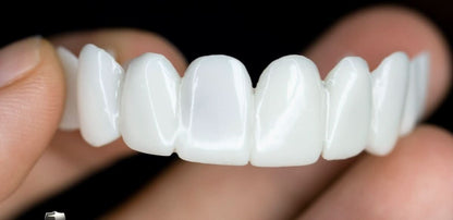 Dentures Flexible Smile Prosthetic White Tooth Lenses