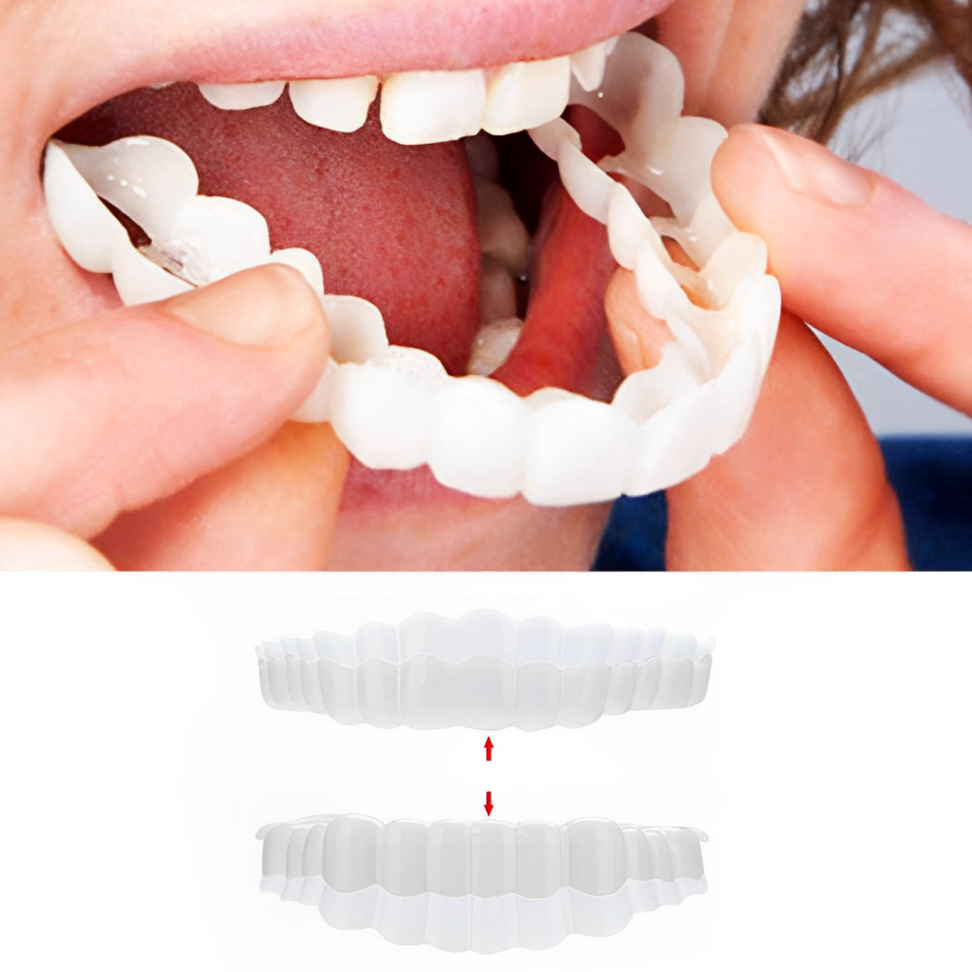 Dental Veneers for Crooked or Stained Teeth – Clip-On Smile Cover, Fast & Comfortable