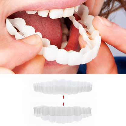 Dental Veneers for Crooked or Stained Teeth – Clip-On Smile Cover, Fast & Comfortable