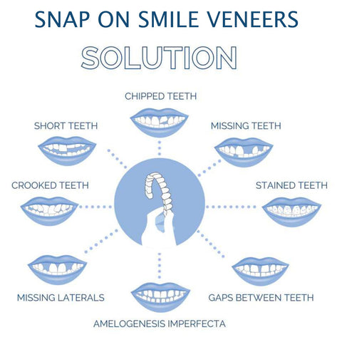 Dental Veneers for Crooked or Stained Teeth – Clip-On Smile Cover, Fast & Comfortable