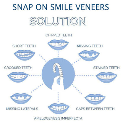 Dental Veneers for Crooked or Stained Teeth – Clip-On Smile Cover, Fast & Comfortable